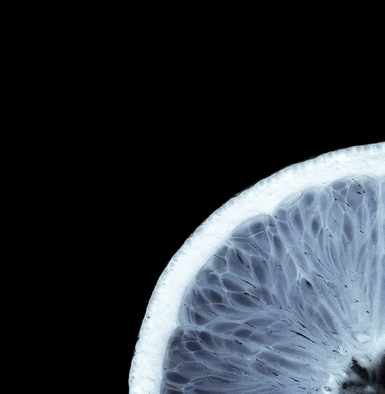 Xray Header V2 Bright Tall